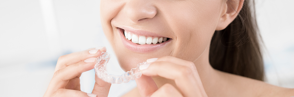 Utilizzare Invisalign