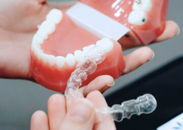 Allineatori trasparenti