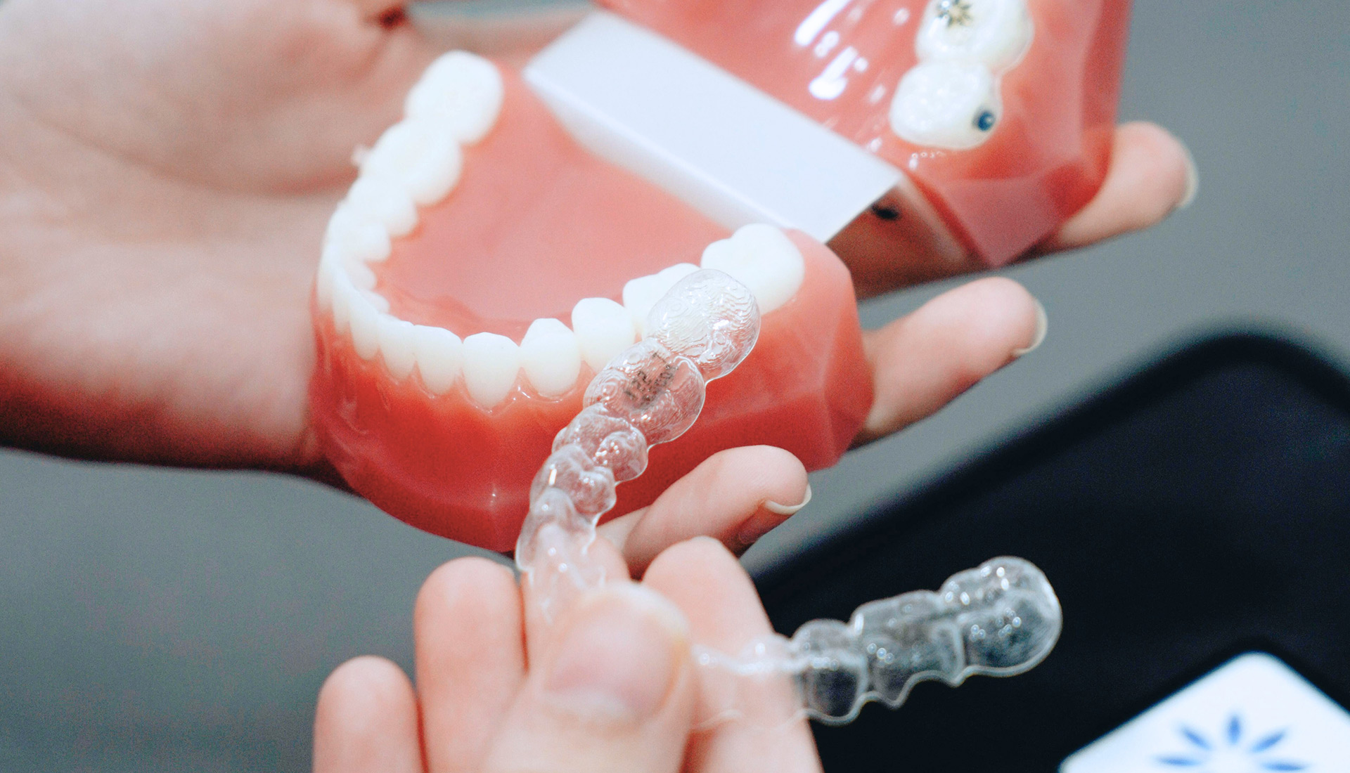 Allineatori trasparenti